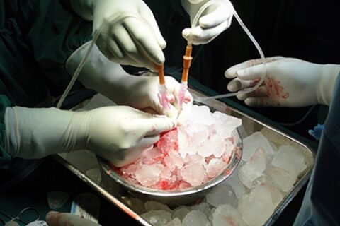 Dažnai transplantacijos laukimo laikas jau trumpesnis nei privaloma tarnyba Lietuvos kariuomenėje