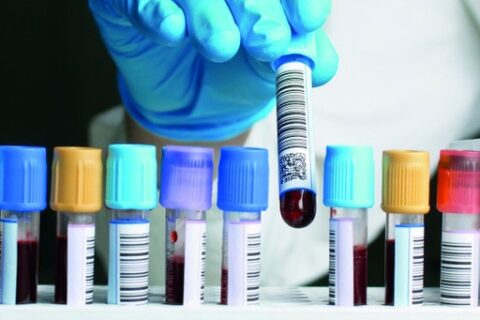 VĖŽIO ŽYMENŲ TYRIMAI – dar viena galimybė vėžio diagnostikoje