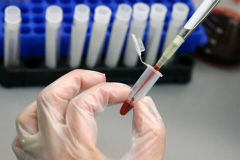 Utenos apskrityje nustatyti 9 ŽIV užsikrėtę asmenys