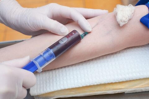 Prostatos vėžys: sergamumas Lietuvoje didėja, pasitikrina tik kas ketvirtas vyras
