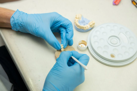 Dantų implantų kaina: kiek racionalu mokėti?