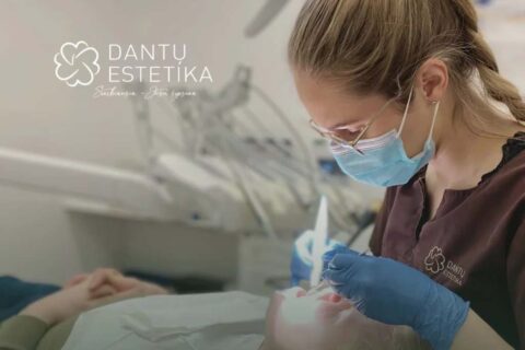 Kaip tinkamai prižiūrėti dantis po implantavimo procedūros?